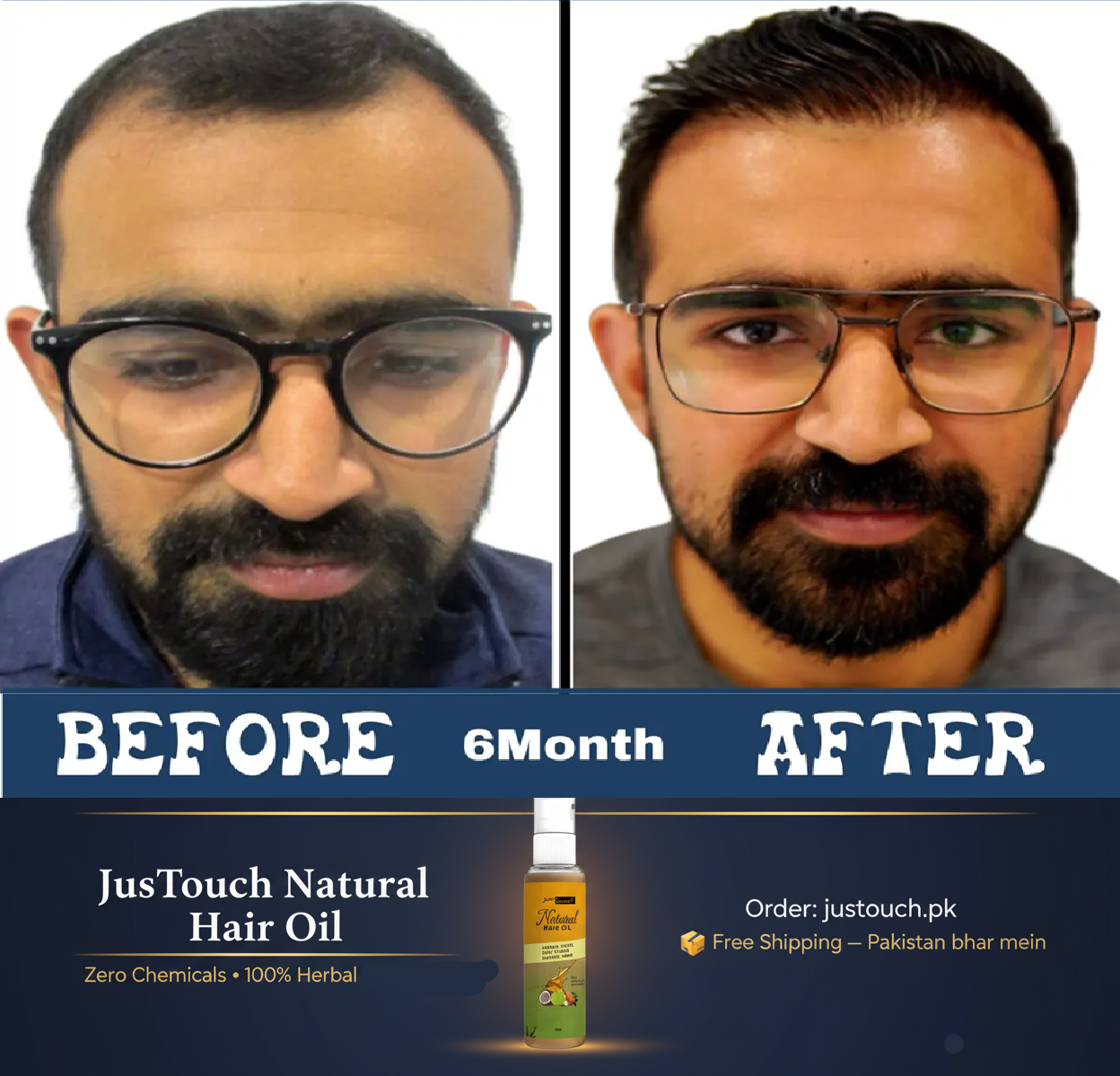 Before and after comparison of a man's beard with JusTouch Natural Hair Oil